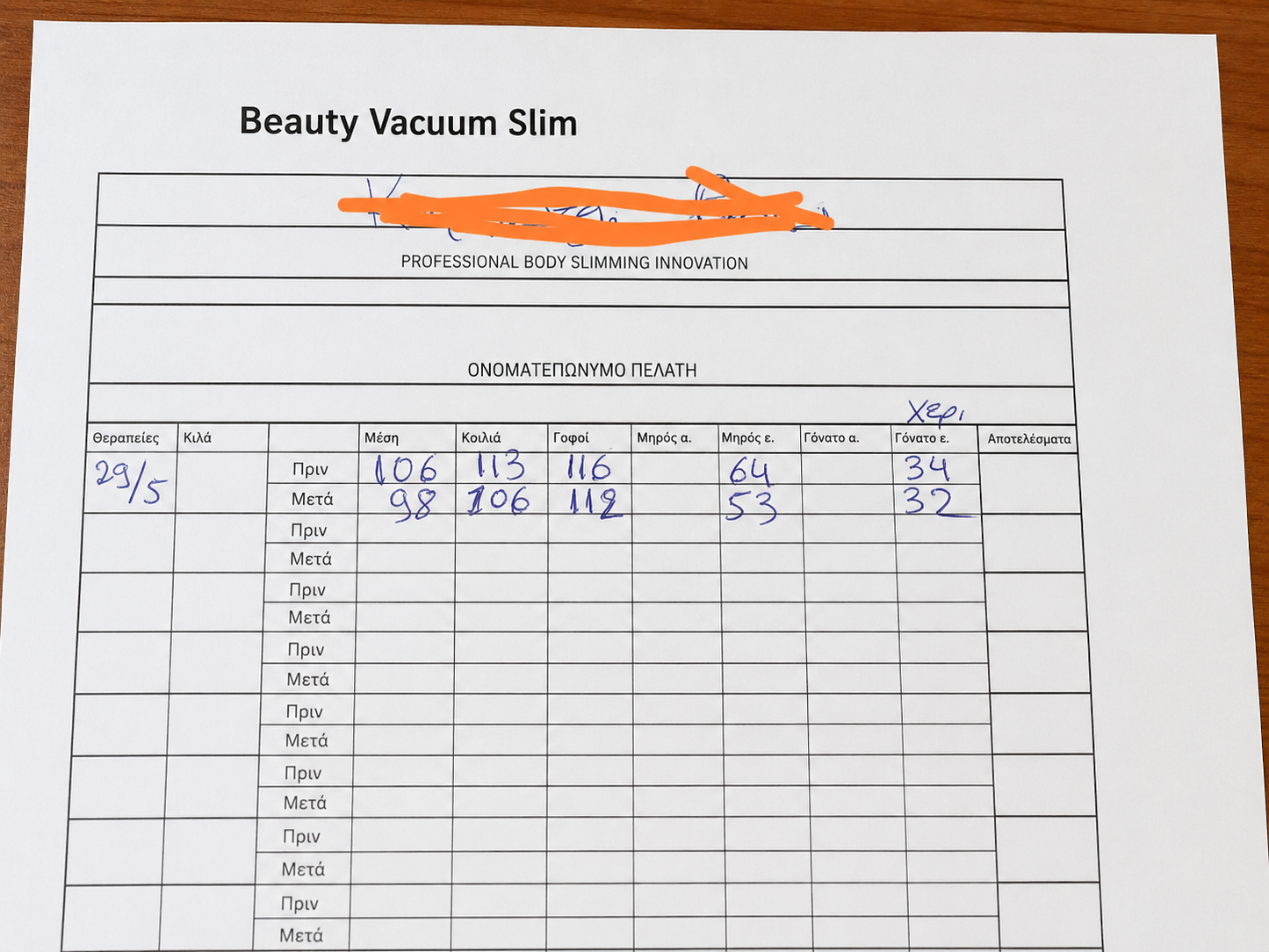 Beauty Vacuum Slim real client results measurement chart showing centimeter loss - BeautyBeauty.gr